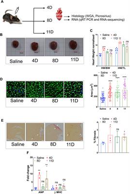 Transcriptional changes during isoproterenol-induced cardiac fibrosis in mice